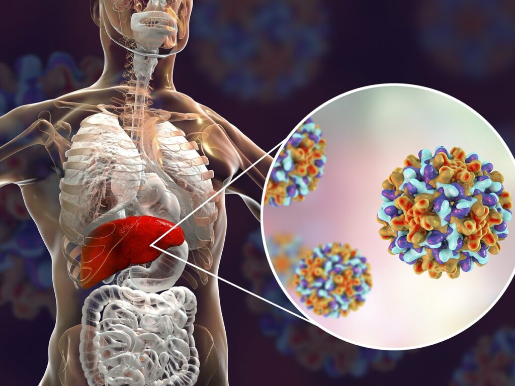 Hepatitis tóxica causas síntomas y prevención de la hepatotoxicidad