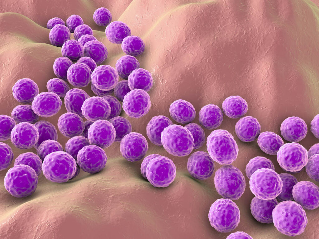 Staphylococcus aureus causas síntomas y tratamiento Remedios caseros