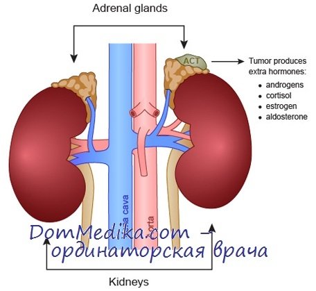 adrenal adenoma