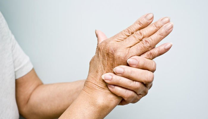 Cómo se siente la artritis en etapas tempranas