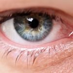 Dolor agudo en el ojo causas y opciones de tratamiento