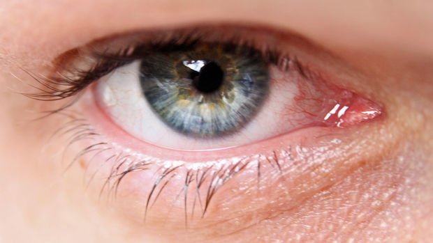 Dolor agudo en el ojo causas y opciones de tratamiento