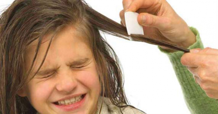 El tinte para el cabello matará a los piojos