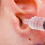 Eliminación de cera de oído con peróxido de hidrógeno