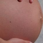 Gas oloroso durante el embarazo temprano o tardío