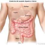 Obstrucción intestinal grande (obstrucción intestinal)