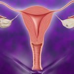 Sangrado uterino disfuncional causas síntomas y tratamiento