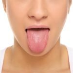 causas de la lengua amarilla en humanos