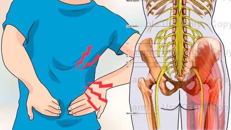 como aliviar el dolor de la pierna