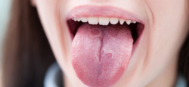 dolor de lengua