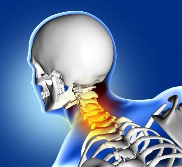 complicaciones cervicales espina fractura