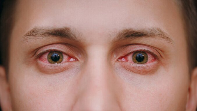 corneal abrasion causes symptoms tiempo de recuperacion