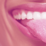 manchas blancas en la lengua
