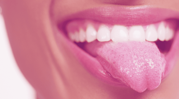 manchas blancas en la lengua