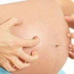 picazon durante el embarazo