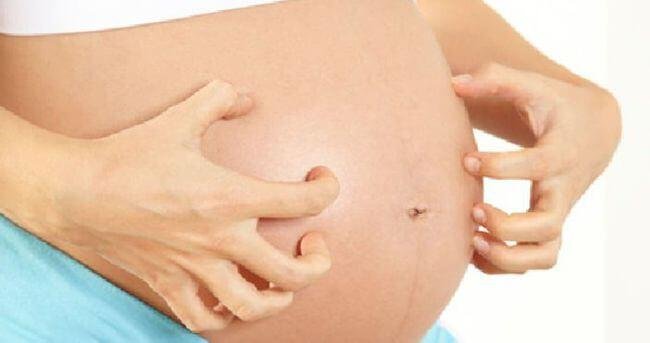picazon durante el embarazo