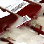reaccion de transfusion hemolitica