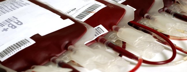 reaccion de transfusion hemolitica