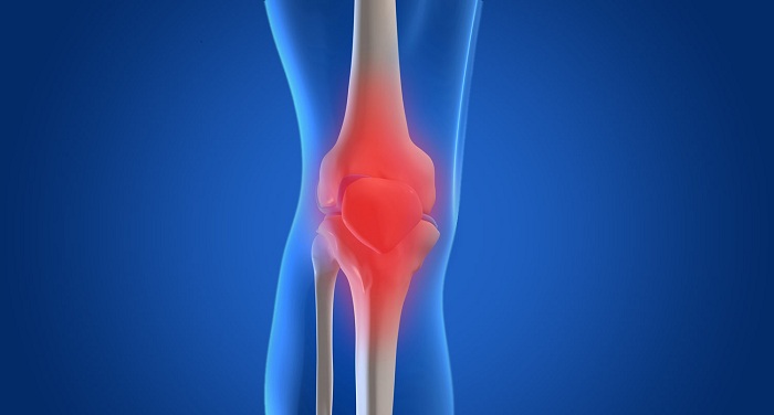 rodilla-cartilago-reemplazo-cirugia