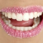 que causa las manchas blancas en los dientes