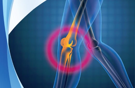 saber-todo-sobre-la-artroplastia-robotica-de-rodilla