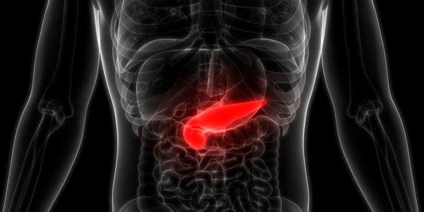 el-cancer-de-pancreas-causa-sintomas-tratamiento-y-prevencion
