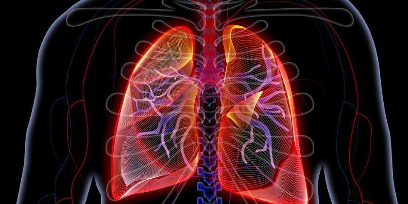 enfermedad-pulmonar-intersticial-causa-sintomas-tratamientos