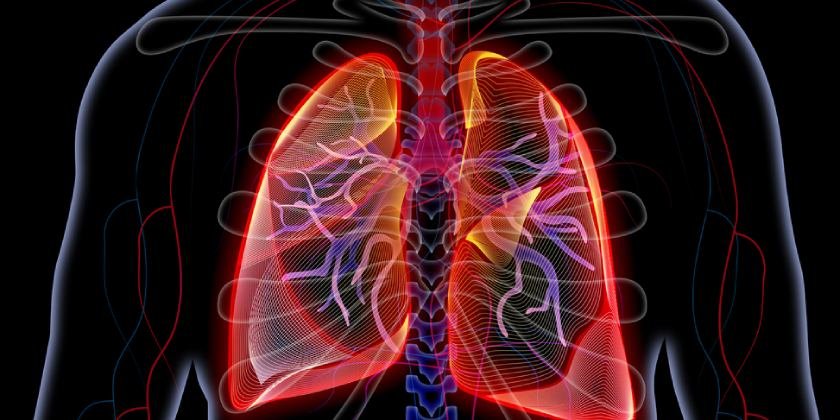 enfermedad-pulmonar-intersticial-sintomas-tipos-tratamiento