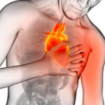 la-enfermedad-de-las-valvulas-cardiacas-causa-sintomas-tratamiento-y-prevencion