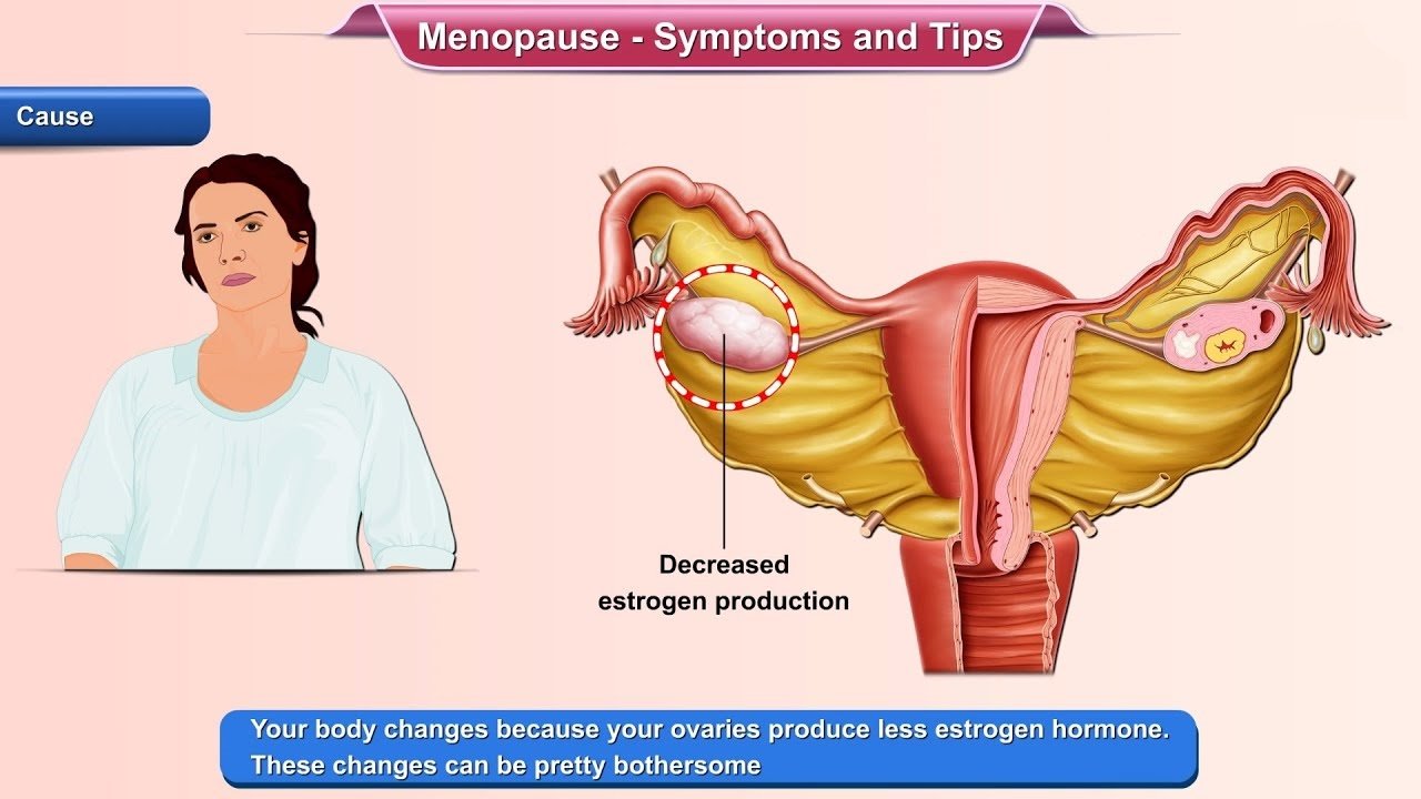 la-menopausia-causa-sintomas-tratamientos-y-modificaciones-en-el-estilo-de-vida
