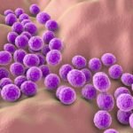 staphylococcus-aureus-causa-sintomas-tratamiento