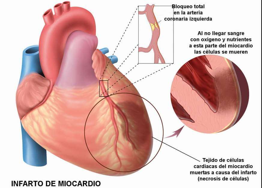 sindrome-de-barlow-causas-sintomas-tipos-y-tratamiento