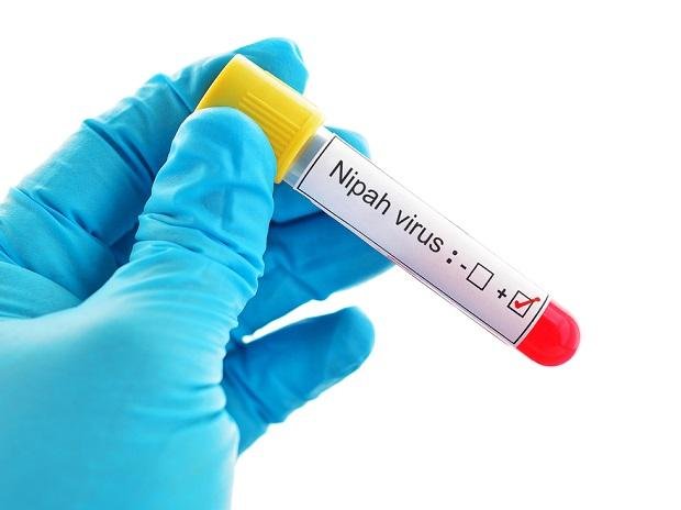 Qué es el virus Nipah